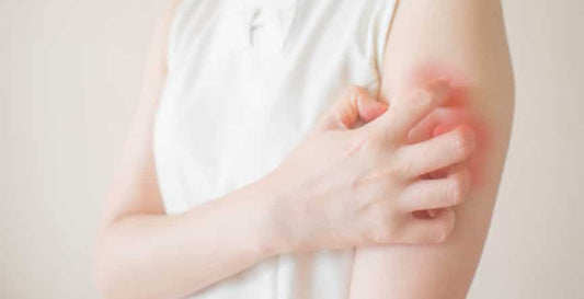 a girl itching her arm due to allergy